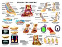 Navicular Anatomy Chart by Susan Hakola