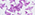 W31I78K1Z90-AFVM
