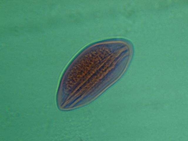 Ascaris Round Worm Egg