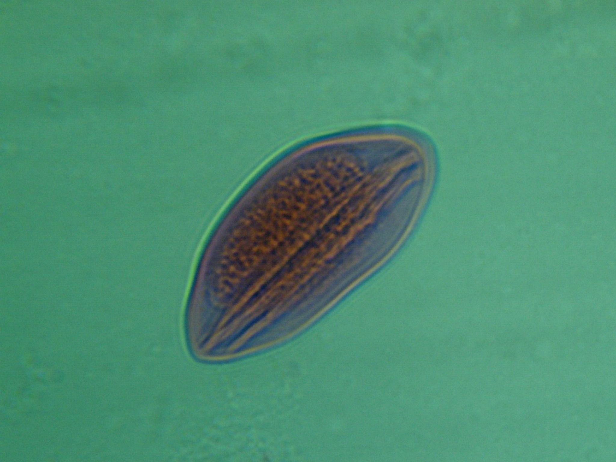 Ascaris Round Worm Egg