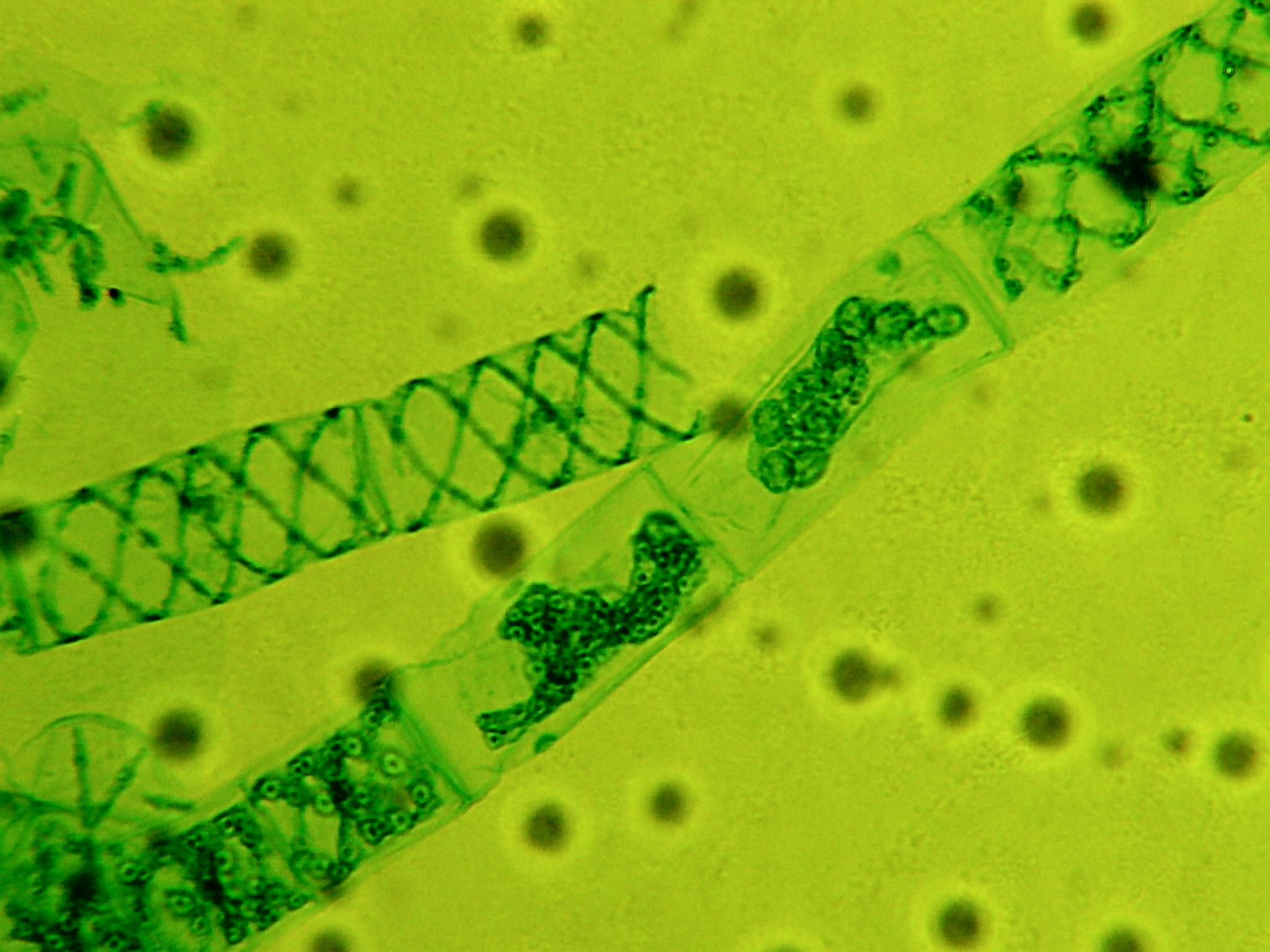 Green Alga Spirogyra | Microscope Images at Orion Telescopes