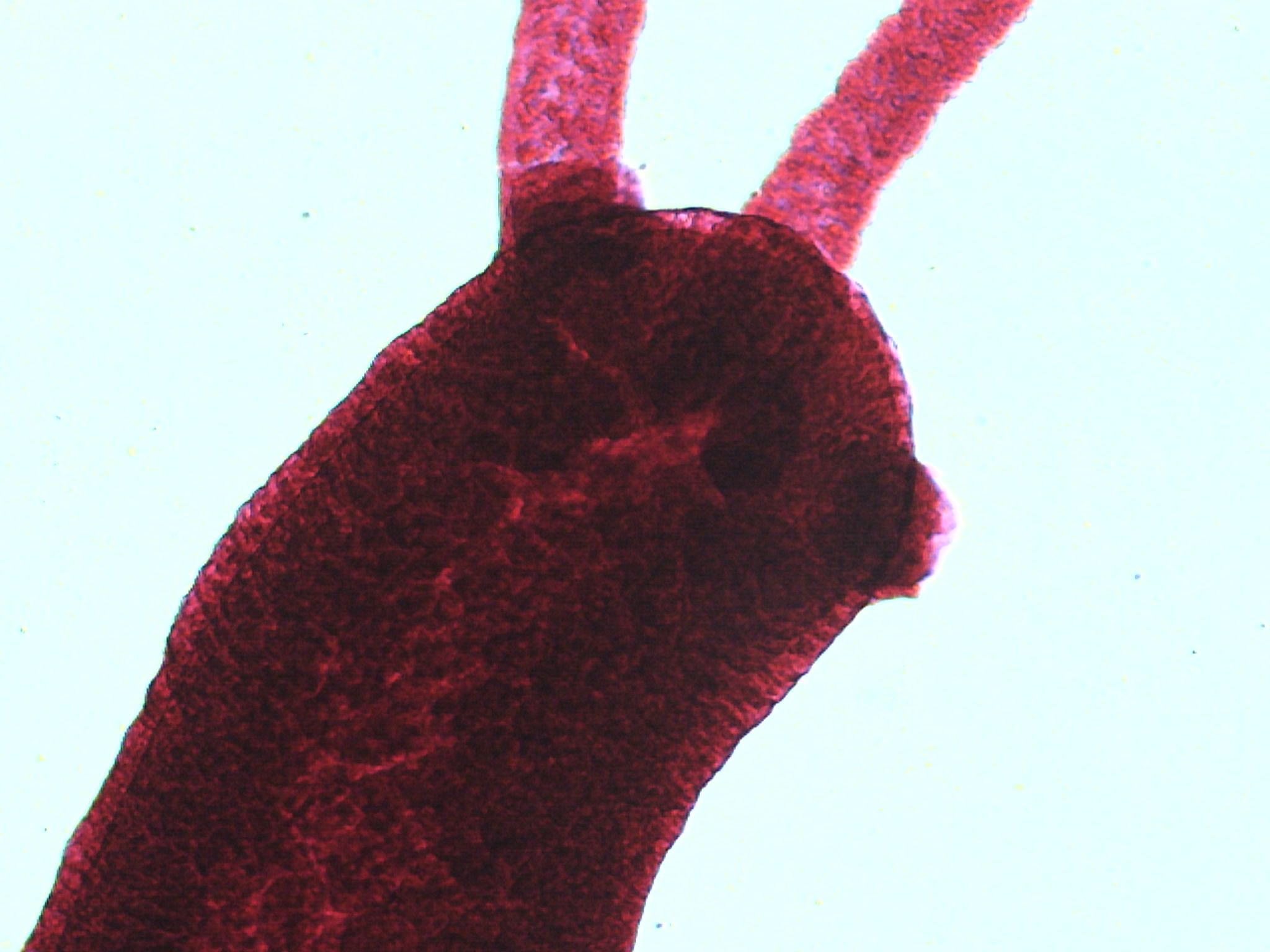 Hydra (genus)