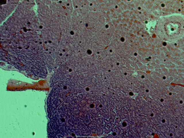 Pancreas Gland