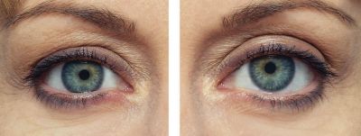 Dream Look Instant Eye Lift