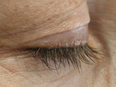 Rapidlash Eyelash Renewal Serum