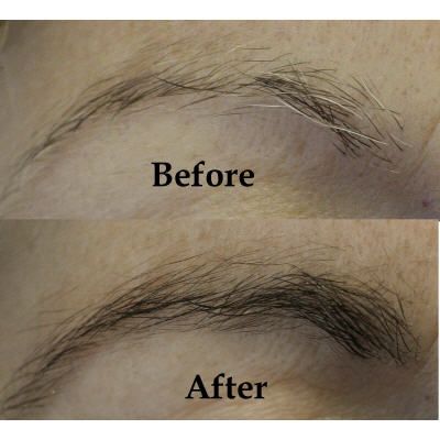 Rapidlash Eyelash Renewal Serum