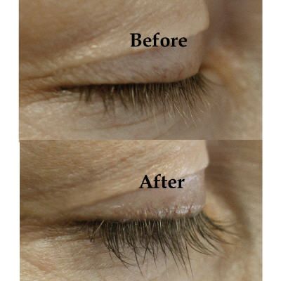 Rapidlash Eyelash Renewal Serum