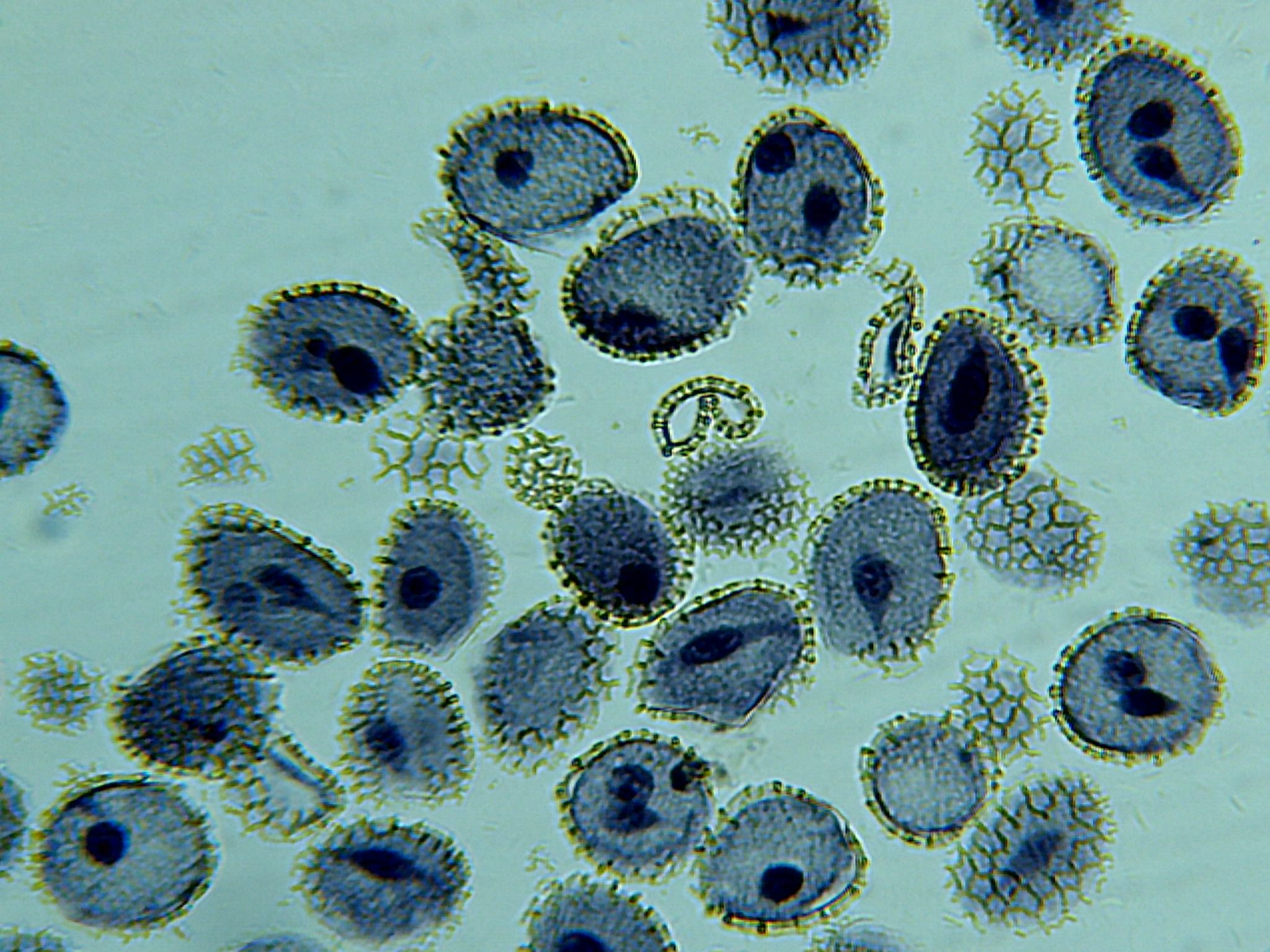 Пыльца и споры. Пыльца микроскопия. Микропрепарапыльца сосны. Пыльцевое зерно микроскоп. Пыльца нарцисса микроскопия.