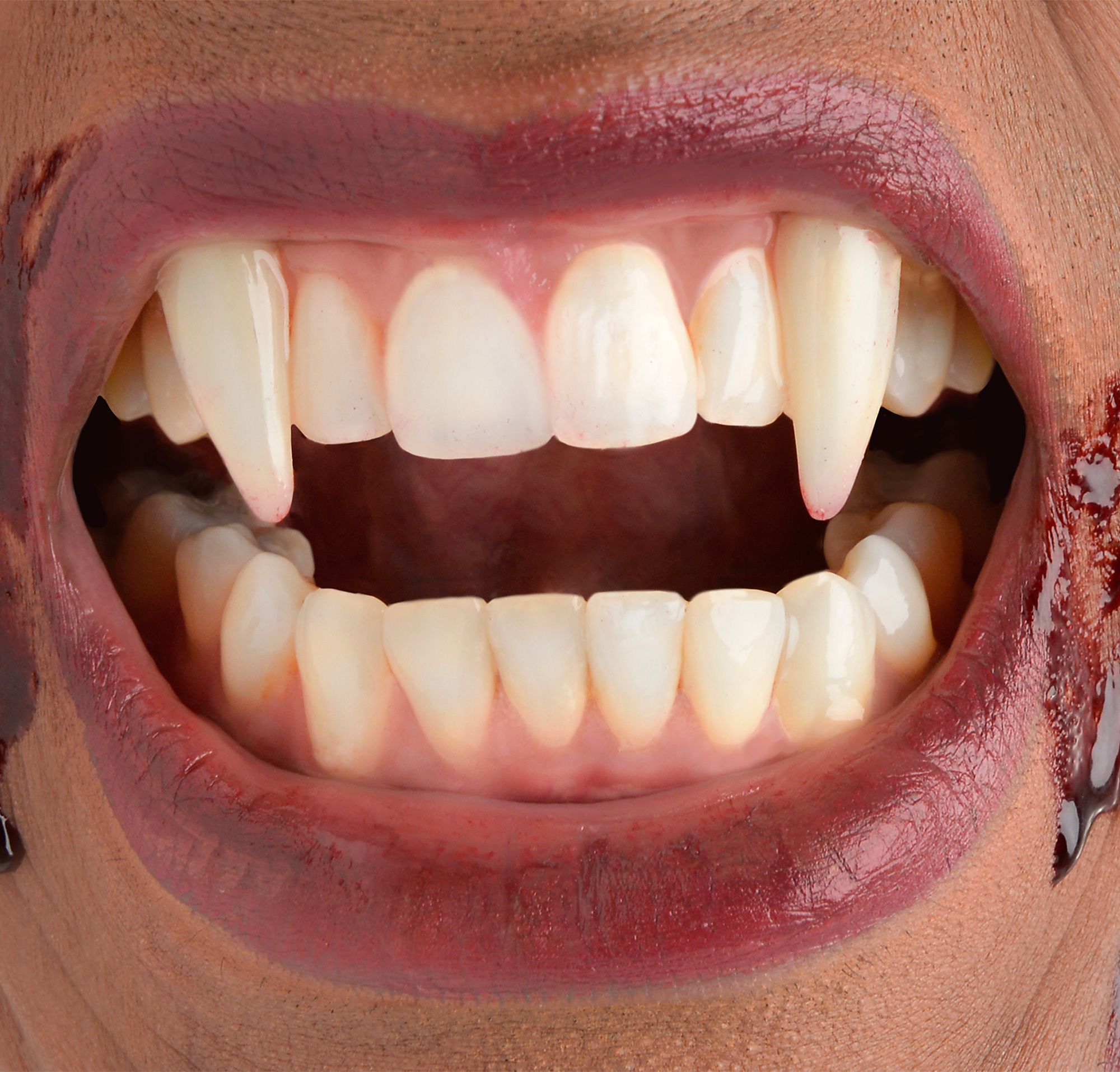Форма зубов клыки